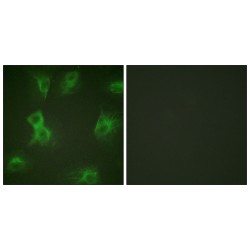 Hepatocyte Growth Factor-Regulated Tyrosine Kinase Substrate Phospho-Tyr334 (HGS pY334) Antibody