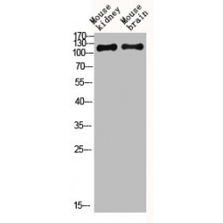 Metabotropic Glutamate Receptor 5 (GRM5) Antibody