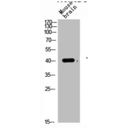 Transforming Growth Factor Beta 1 (TGFB1) Antibody