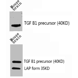 Transforming Growth Factor Beta 1 (TGFB1) Antibody