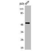 abx329397