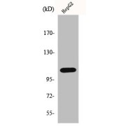 Western Blot analysis of HepG2 cells using Endoplasmic Reticulum Aminopeptidase 1 Antibody.