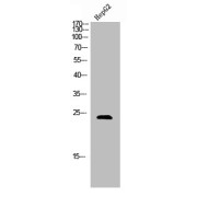 WB analysis of HepG2 cells.