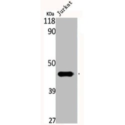 Creatine Kinase M-Type (CKM) Antibody