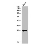 WB analysis of HeLa cells, using IL12A antibody.