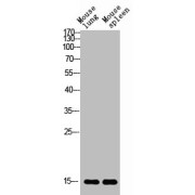 Western blot analysis of (1) Mouse Lung Tissue, and (2) Mouse Spleen Tissue, using BATF3 antibody (1/2000 dilution) followed by secondary antibody (1/20000 dilution).