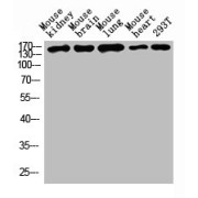 WB analysis of mouse kidney tissue, mouse brain tissue, mouse lung tissue, mouse heart tissue, and 293T whole cell lysate, using DSG1 antibody (1/1000 dilution).