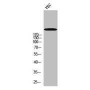 WB analysis of VEC, using POLR2A pS1619 Antibody.