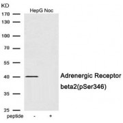 WB analysis of extracts from HepG2 cells treated with Nocodazole. The lane on the right is treated with the antigen-specific peptide.