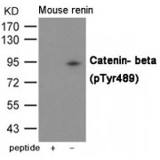 Catenin Beta-1 Phospho-Tyr489 (CTNNB1 pY489) Antibody