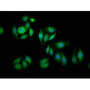 IF staining of A549 cells, using EIF1 Antibody (1/100 dilution) and counter-staining with DAPI. The cells were fixed in 4% formaldehyde, permeabilised using 0.2% Triton X-100 and blocked in 10% normal Goat Serum. The cells were then incubated with the antibody overnight at 4 °C. The secondary antibody was AF488-congugated Goat Anti-Rabbit IgG (H+L).