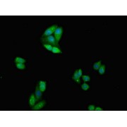IF analysis of HepG2 cells, using CTLA4 antibody (1/100 dilution) and AF488-conjugated Goat anti-Rabbit IgG (H+L).