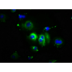 Cadherin-1 (CDH1) Antibody