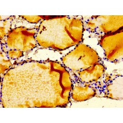 Insulin Like Growth Factor Binding Protein 6 (IGFBP6) Antibody