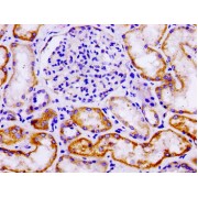 IHC-P analysis of human kidney tissue, using LAMA3 antibody (1/100 dilution). After dewaxing and hydration, antigen retrieval was mediated by high pressure in citrate buffer (pH 6.0). The section was blocked with 10% normal goat serum for 30 min at RT. The primary antibody (1% BSA) was incubated at 4°C overnight, followed by biotin-conjugated secondary antibody and visualization using an HRP-conjugated SP system.