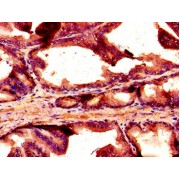 IHC-P analysis of human prostate tissue, using NOX1 antibody (1/100 dilution).