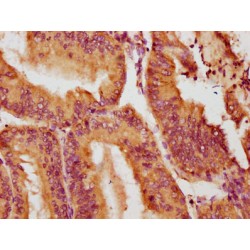 NADPH Oxidase 1 (NOX1) Antibody