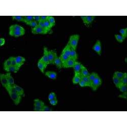 Acid-Sensing Ion Channel 2 (ASIC2) Antibody