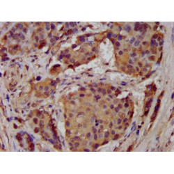 Acid-Sensing Ion Channel 2 (ASIC2) Antibody