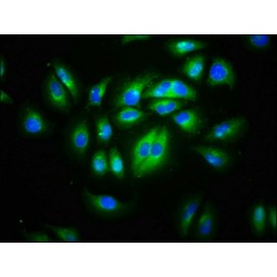 CD99 Molecule Like 2 (CD99L2) Antibody