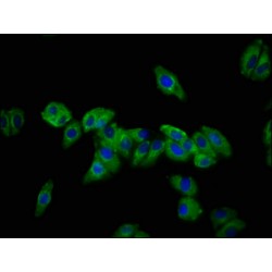 Desmocollin 3 (DSC3) Antibody
