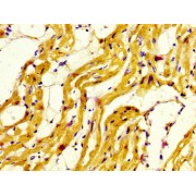 Immunohistochemistry analysis of paraffin-embedded Human Heart tissue using Myosin 7 (MYH7) Antibody (1/800 dilution, 1% BSA, 4°C overnight) and biotinylated secondary visualised using an HRP-conjugated SP system. High pressure antigen retrieval was carried out in citrate buffer, pH 6.0, and sample was blocked with 10% normal goat serum prior to primary incubation.