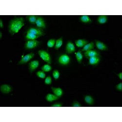 Serotonin N-Acetyltransferase (AANAT) Antibody