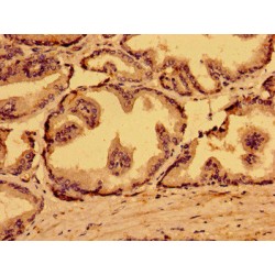 Methionine-tRNA Ligase, Mitochondrial (MARS2) Antibody
