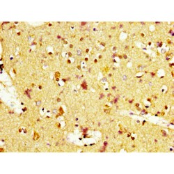 Melanocyte-Stimulating Hormone Receptor (MC1R) Antibody