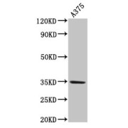 abx338543