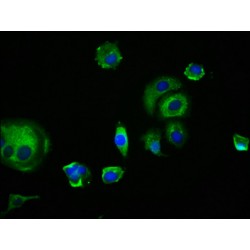 Tumor necrosis factor receptor superfamily member EDAR (EDAR) Antibody