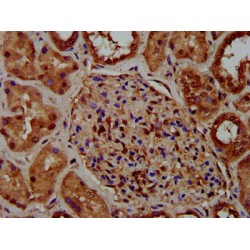 Cytoskeleton-Associated Protein 5 (CKAP5) Antibody