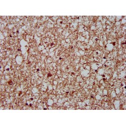 Cytoskeleton-Associated Protein 5 (CKAP5) Antibody
