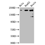 WB analysis of HeLa whole cell lysate, HepG2 whole cell lysate and Rat brain tissue lysate, using Cytoskeleton-Associated Protein 5 (CKAP5) antibody (6 μg/ml) followed by a Goat anti-Rabbit IgG antibody (1/50000 dilution). Calculated MW: 219 kDa, 226 kDa and 227 kDa, Observed MW: 226 kDa.