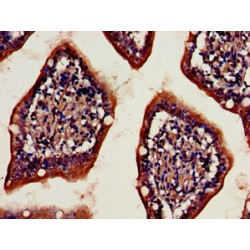 Dipeptidyl Peptidase 4 / CD26 (DPP4) Antibody