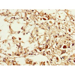 Melanoma-Associated Antigen 3 (MAGEA3) Antibody