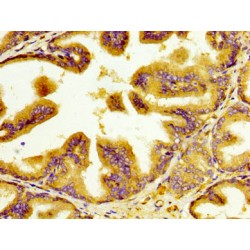 Insulin Like Growth Factor 2 mRNA Binding Protein 1 (IGF2BP1) Antibody