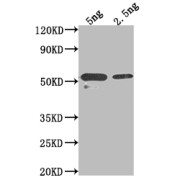 Western blot analysis of recombinant Mouse Asialoglycoprotein receptor 2 using Asialoglycoprotein Receptor 2 (ASGR2) Antibody (1/2000 dilution) and Goat Anti-Rabbit IgG (1/50000 dilution). <p></p>Calculated MW: 45.9 kDa<br>Observed MW: 52 kDa