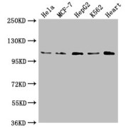 WB analysis of HeLa, MCF-7, HepG2, K562 cell lysates and Mouse heart tissue lysate, using OPA1 antibody (1/2000 dilution) followed by a Goat anti-Rabbit IgG antibody (1/50000 dilution). Calculated MW: 112 kDa, 116 kDa, Observed MW: 112 kDa.