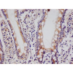 Proteasome activator complex subunit 1 (PSME1) Antibody