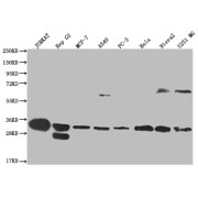 Western blot analysis of Jurkat (Lane 1), HepG2 (Lane 2), MCF-7 (Lane 3), A549 (Lane 4), PC-3 (Lane 5), HeLa (Lane 6), Ntera-2 (Lane 7), U251 (Lane 8) whole cell lysates using Proteasome activator complex subunit 1 Antibody (1/2000 dilution), followed by Goat Anti-Rabbit IgG (1/50000 dilution).<p></p>Calculated MW: 29 kDa, 27 kDa<p></p>Observed MW: 28-30 kDa, 55-72 kDa.