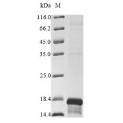 SDS-PAGE analysis of recombinant Human c10orf99 protein.