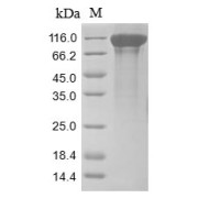 Discontinuous SDS-PAGE (reduced) analysis with 5% enrichment gel and 15% separation gel, using Tris-glycine gel.