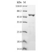 SDS-PAGE (reduced) analysis of recombinant SARS-CoV-2/COVID-19/2019-nCoV nucleoprotein (Tris-glycine gel, 5% enrichment gel and 15% separation gel).