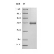 SDS-PAGE (reduced) analysis of recombinant SARS-CoV-2/COVID-19/2019-nCoV spike glycoprotein (Tris-glycine gel, 5% enrichment gel and 15% separation gel). Predicted band size: 30.1 kDa, Observed band size: 35 kDa (difference due to glycosylation).