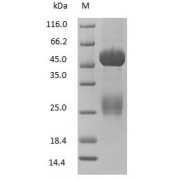 Discontinuous reduced SDS-PAGE (tris-glycine gel) analysis of Rabbit Immunoglobulin G Protein.