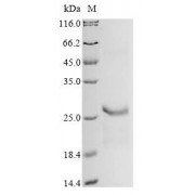 SDS-PAGE analysis of MALD3 Protein.