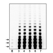 HEK-293T telomerase over-expressing cell pellets express ~400-fold greater telomerase activity over endogenous levels. These HEK-293T cells have been transiently transfected with plasmid DNA encoding hTERT, hTR, and dyskerin, leading to ~400-fold higher enzymatic activity. In this figure, cell aliquots were removed over time for analysis of their telomerase activity using a direct activity assay. Lane E: untransfected, endogenous activity – arrows indicate the first three telomeric repeats. Lanes 3 - 7: activity at days 3 – 7 post-transfection. For more information please see the 2017 <i>METHODS</i> publication, <a href="http://www.sciencedirect.com/science/article/pii/S1046202316302481">http://www.sciencedirect.com/science/article/pii/S1046202316302481</a>. Simply over-expressing just the hTERT protein does not lead to significant increase in telomerase activity because hTR becomes limiting (it might result in 3-5 fold more activity at best). Our product is superior because the cells over-express all three required components of the enzyme complex: hTERT, hTR, and dyskerin. This is the only way to obtain the several-hundred fold increase in enzymatic activity.<br><br>These over-expressing cell pellets allow reliable detection of hTERT protein by Western blotting.<br><br>Each pellet is sufficient for ~20-50 direct telomerase activity assays, as described in: <a href="http://www.sciencedirect.com/science/article/pii/S1046202316302481">http://www.sciencedirect.com/science/article/pii/S1046202316302481</a>.