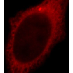 Thioredoxin Domain-Containing Protein 17 (TXNDC17) Antibody