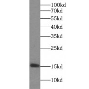 WB analysis of Jurkat cells, using TXNDC17 antibody (1/500 dilution).